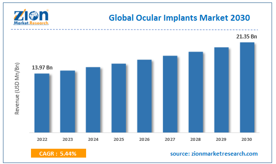 Global Ocular Implants Market Size