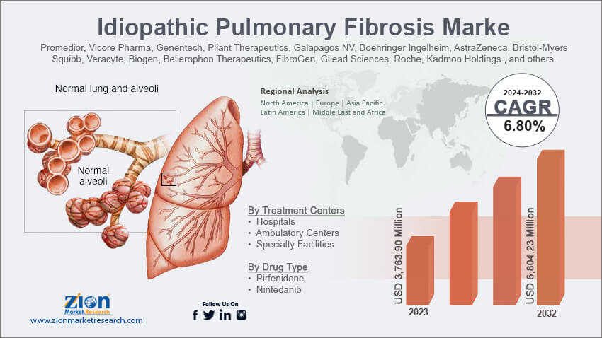 Idiopathic Pulmonary Fibrosis Market