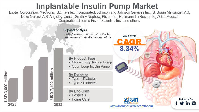 Global Implantable Insulin Pump Market