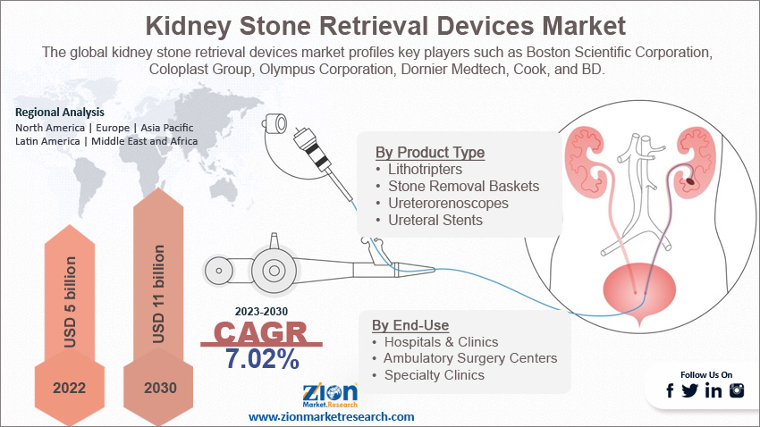 Global Kidney Stone Retrieval Devices Market Size