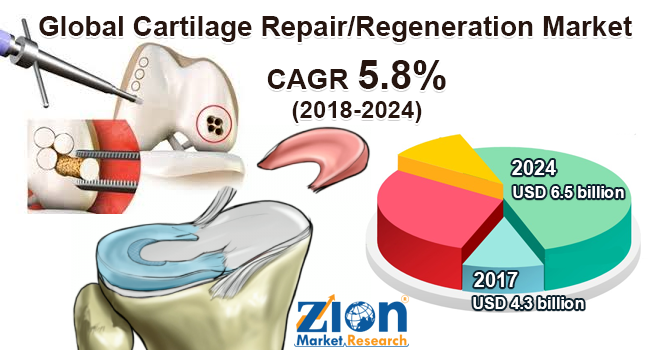 Global Cartilage Repair Regeneration Market