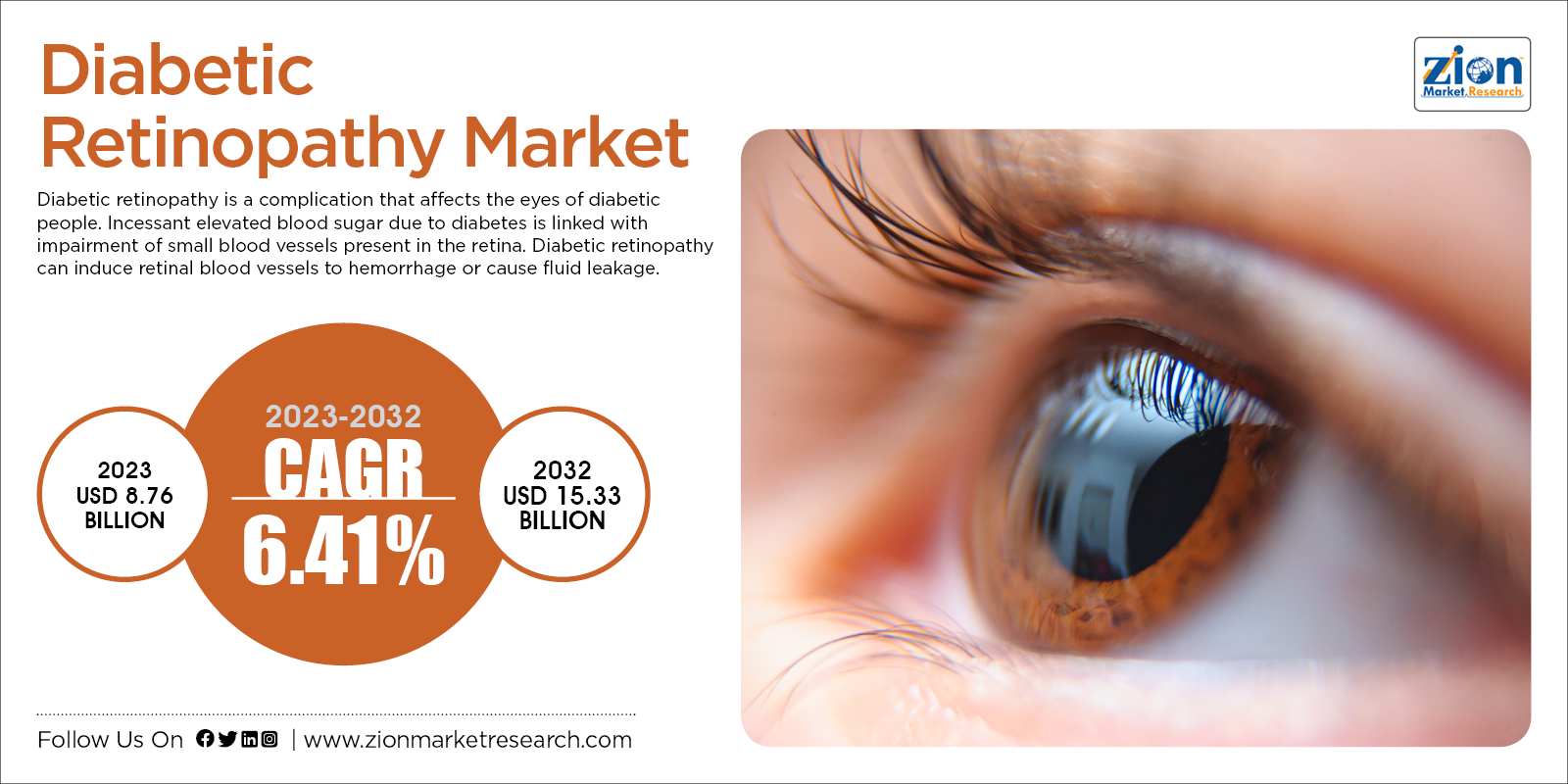 Diabetic-Retinopathy-Market