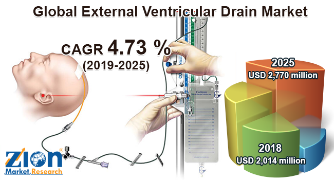 Global External Ventricular Drain Market