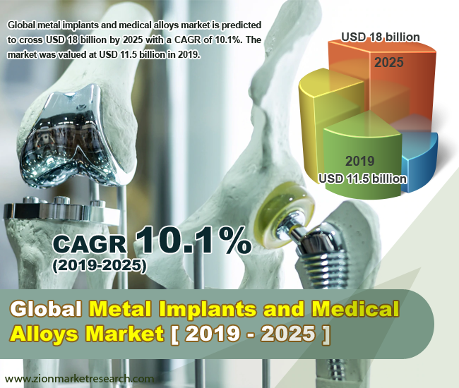 Global Metal Implants And Medical Alloys Market 