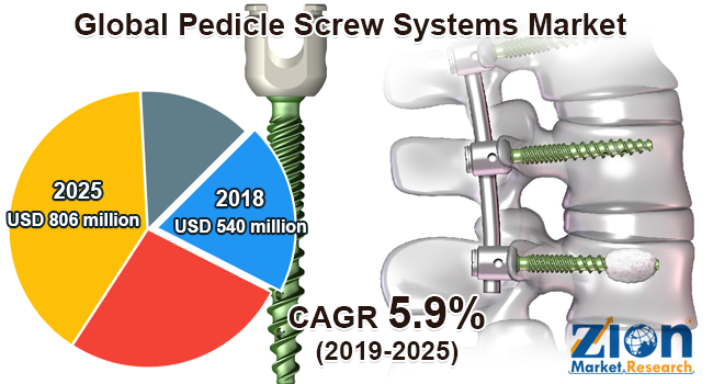 Global Pedicle Screw Systems Market