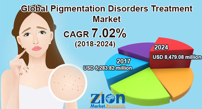 Global Pigmentation Disorders Treatment Market