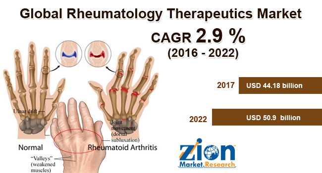 Rheumatology Therapeutics Market