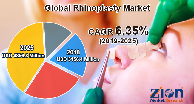 Global Rhinoplasty Market