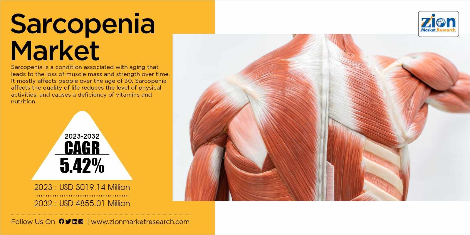 Global Sarcopenia Market