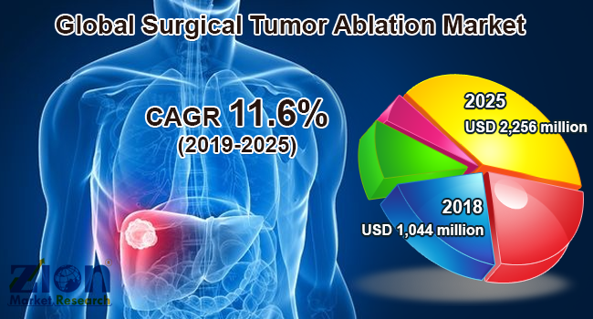 Global Surgical Tumor Ablation Market