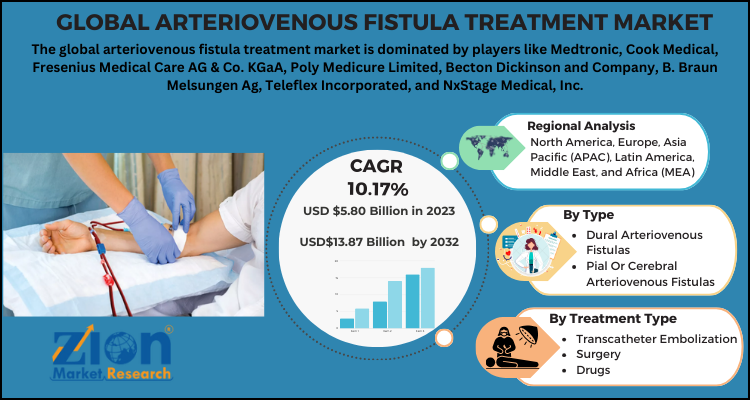 Arteriovenous Fistula Treatment Market