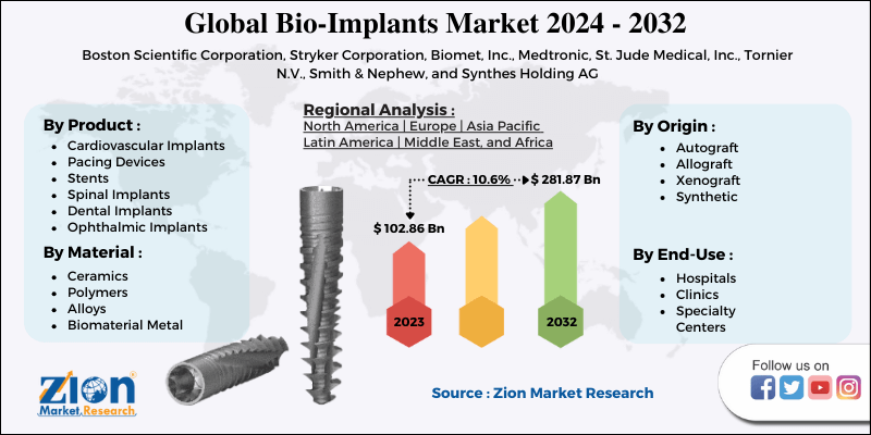 Bio-Implants Market