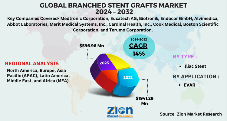 Branched Stent Grafts Market