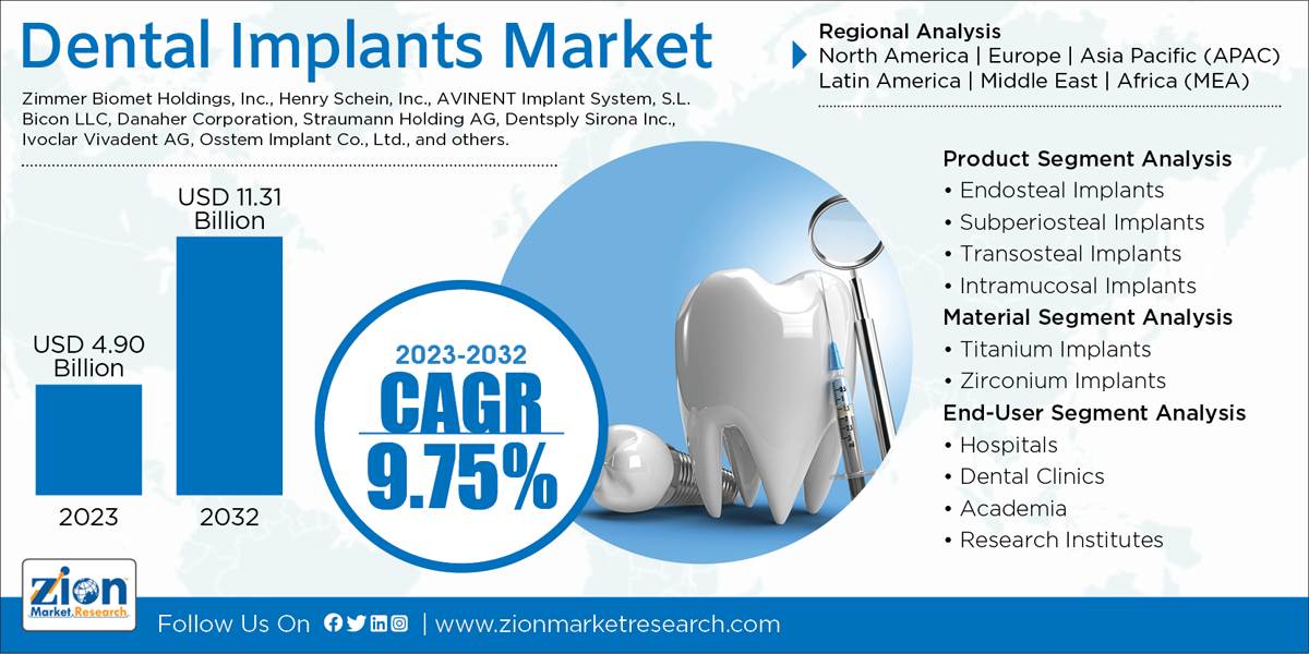 Global Dental Implants Market