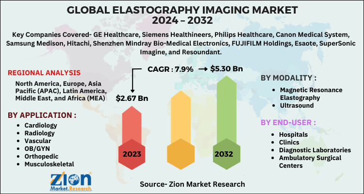 Elastography Imaging Market