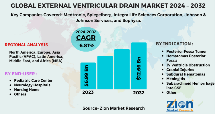 External Ventricular Drain Market