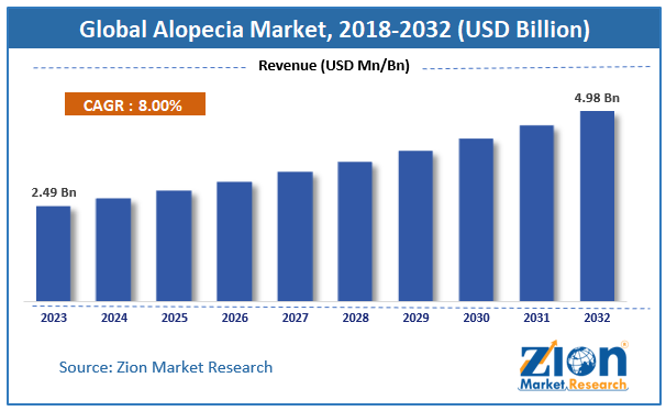 Alopecia Market Size