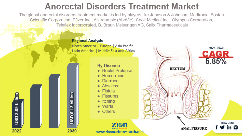 Global Anorectal Disorders Treatment Market Size