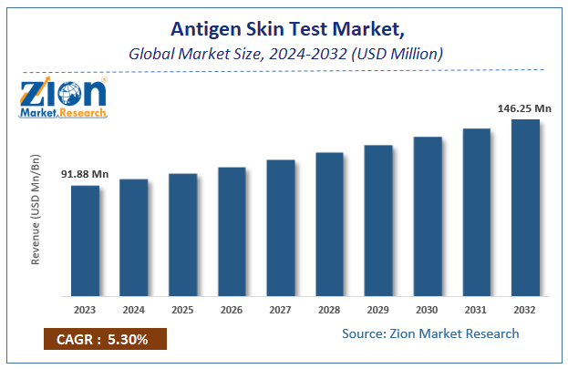 Antigen Skin Test Market Size