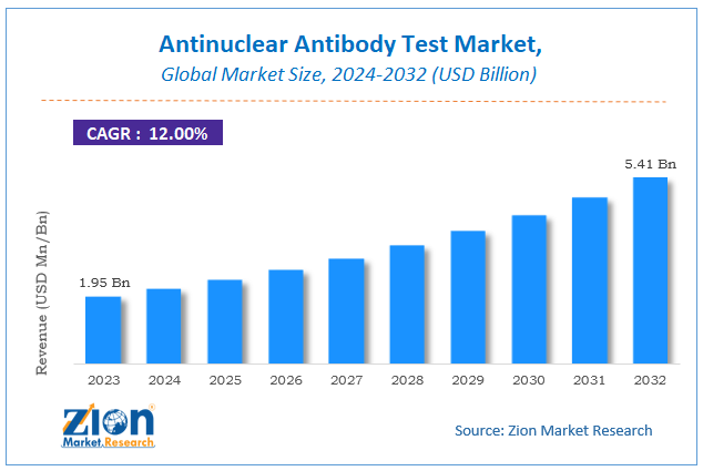 Global Antinuclear Antibody Test Market Size