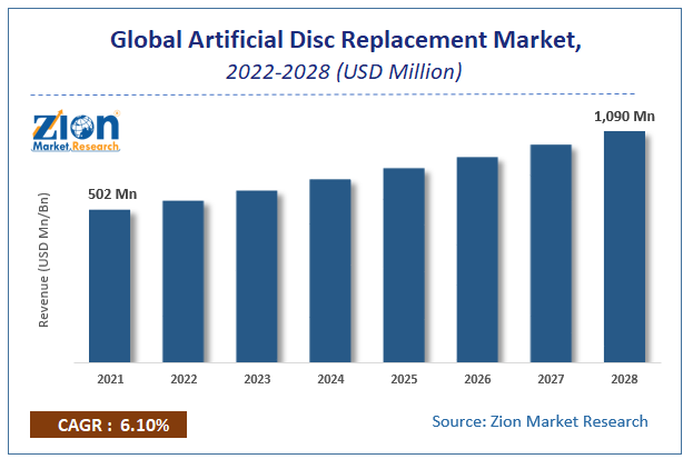 Global Artificial Disc Replacement Market Size