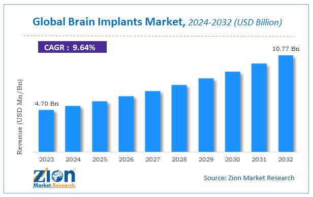 Global Brain Implants Market