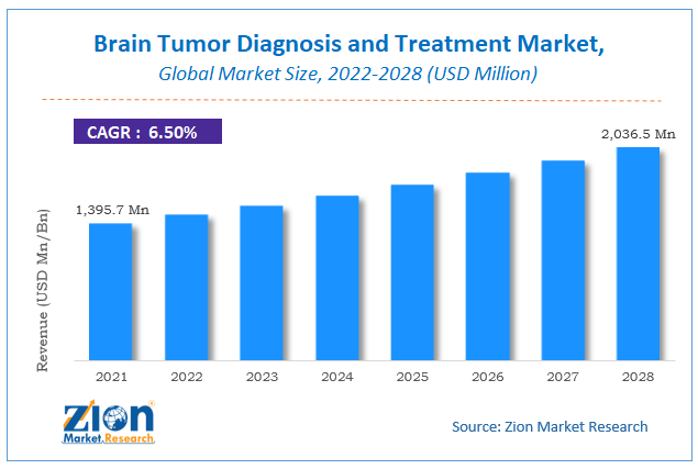 Global Brain Tumor Diagnosis and Treatment Market Size