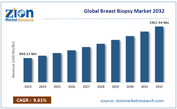 Global Breast Biopsy Market  Size