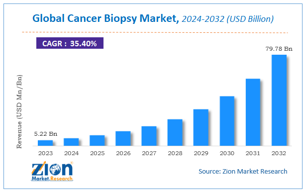 Cancer Biopsy Market Size