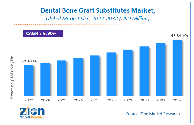 Dental Bone Graft Substitutes Market Size