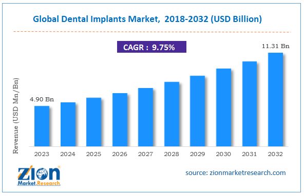 Dental Implants Market Size