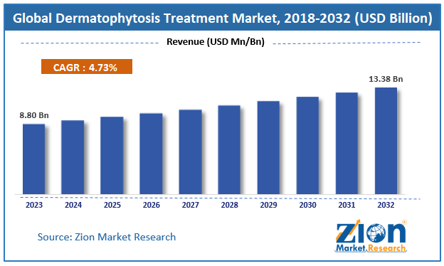 dermatophytosis treatment Market Size