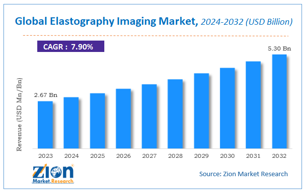 Global Elastography Imaging Market