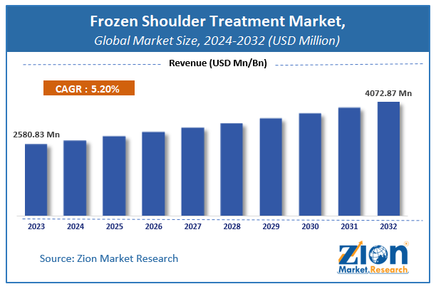 Global Frozen Shoulder Treatment Market Size