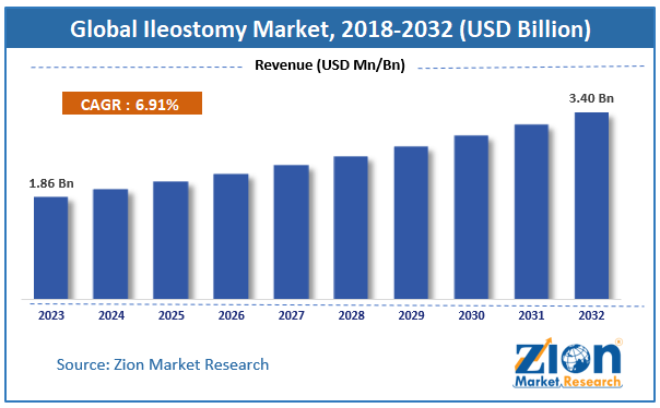 Ileostomy Market size