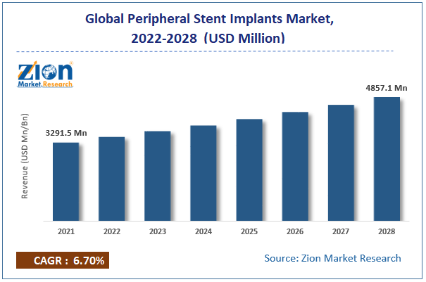 Peripheral Stent Implants Market size