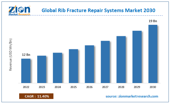 Global Rib Fracture Repair Systems Market Size