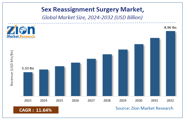 Global Sex Reassignment Surgery Market Size Share Growth 2032