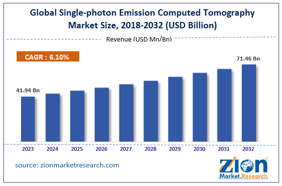 Global Single-Photon Emission Computed Tomography Market Size