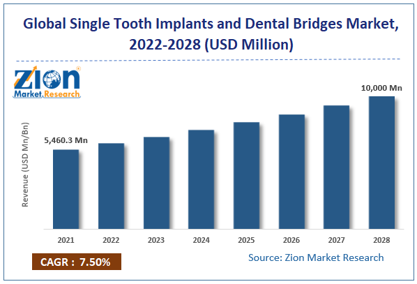 Global Single Tooth Implants and Dental Bridges Market Size