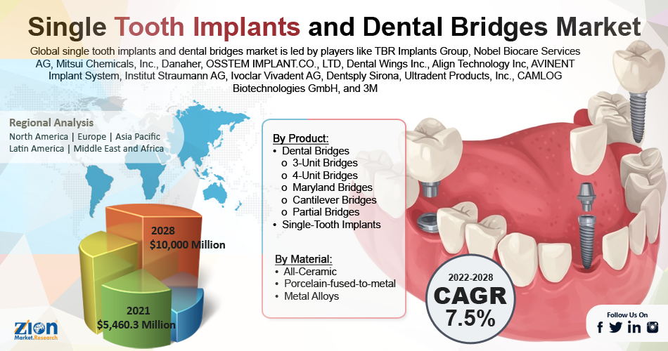 Global Single Tooth Implants and Dental Bridges Market 