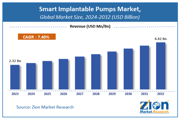 Smart Implantable Pumps Market Size