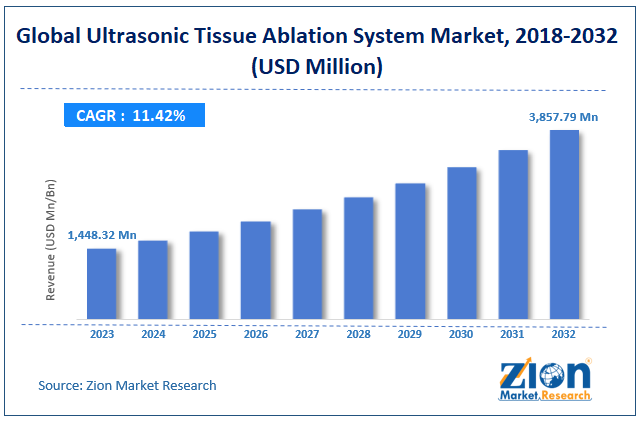 ultrasonic tissue ablation system Market Size