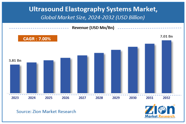 Ultrasound Elastography Systems Market Size