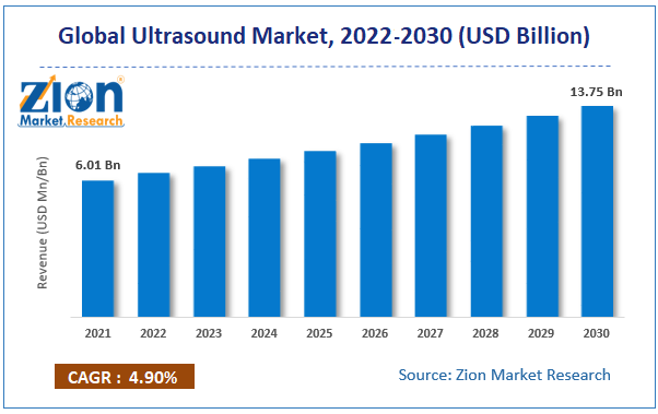  Global Ultrasound Market size