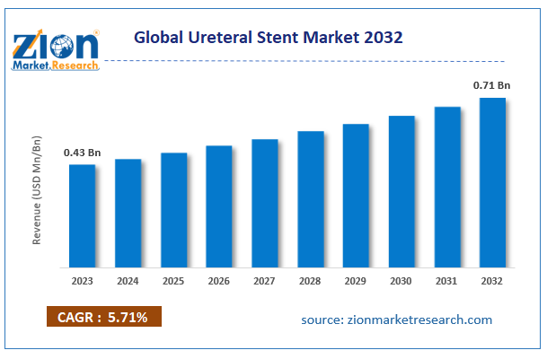 Global Ureteral Stent Market 2032