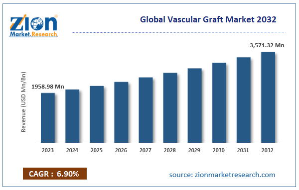 Global Vascular Graft Market Size