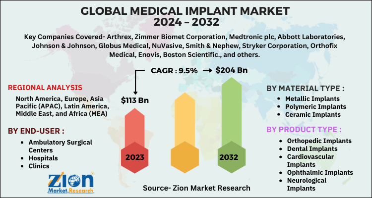 Medical Implant Market