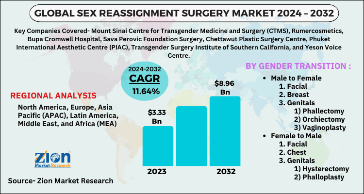 Sex Reassignment Surgery Market